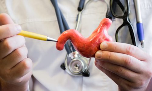 85680097_m-768x512-1