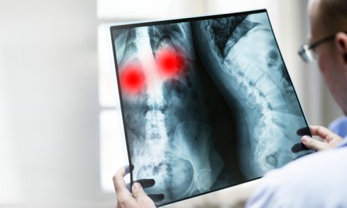 doctor-with-coronavirus-patient-s-x-ray-film