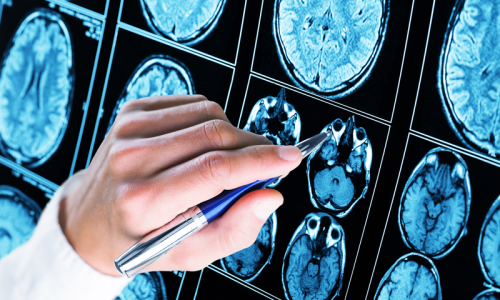 magnetic-resonance-scan-brain-mri-head-scan-medicine-science