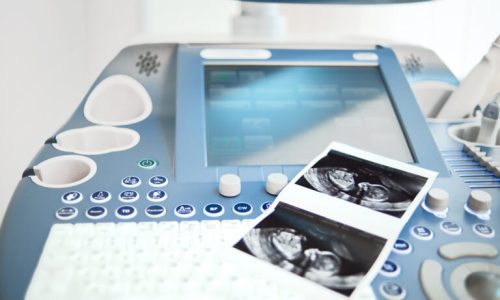 ultrasound-scanning-machine-clinic-768x513